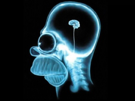 Click on image to see full-sized version Those who argue for nuclear power and have the technical know-how to make it work are a little small-brained in areas of environmental concern.